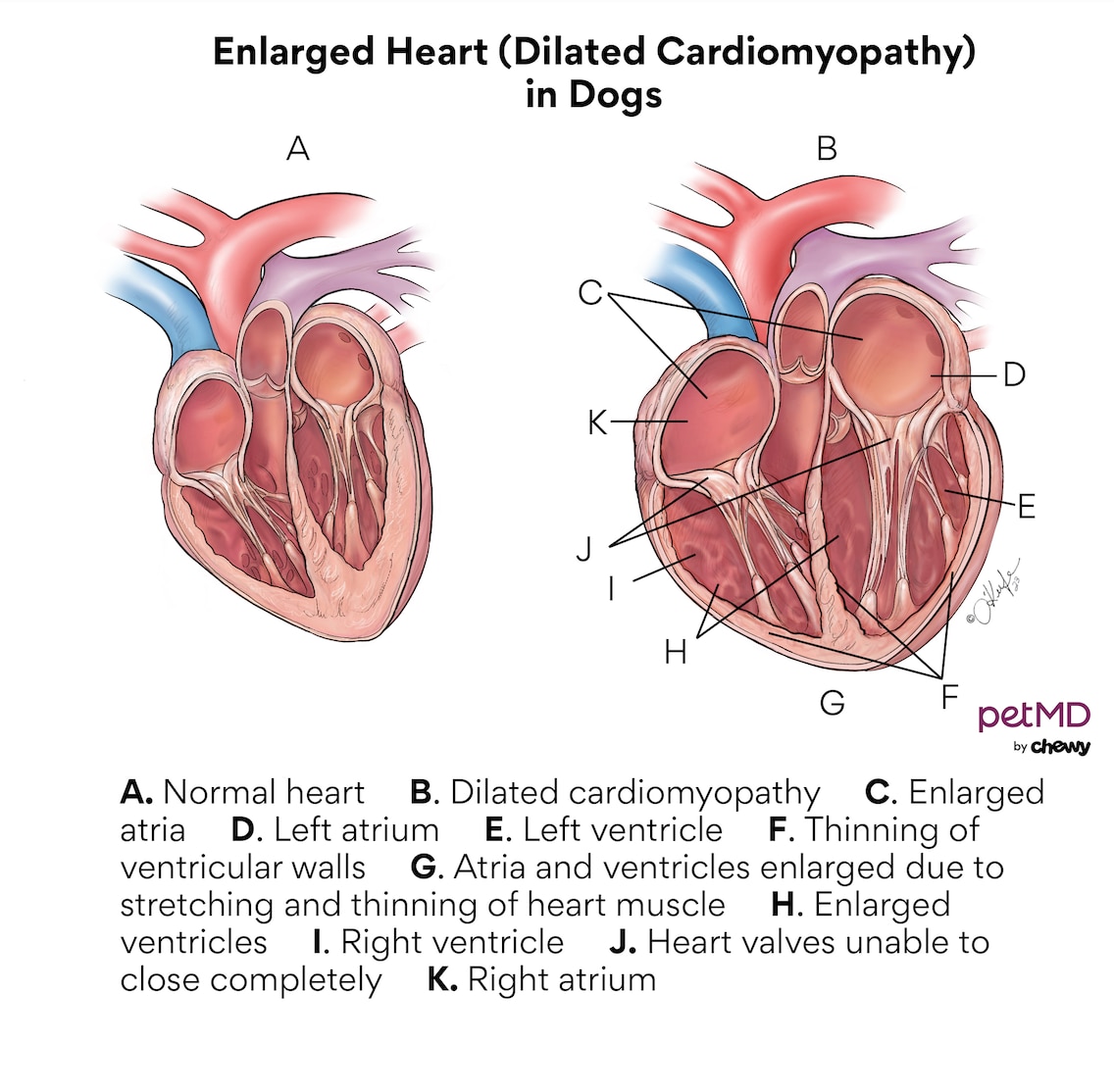 Enlarged Heart Dilated Cardiomyopathy in Dogs PetMD